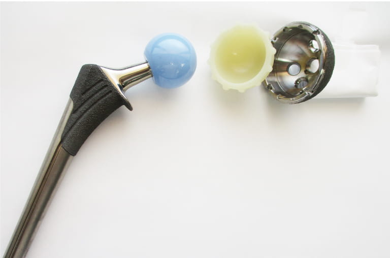 人工関節インプラント